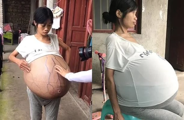 사진출처 / Pear Video