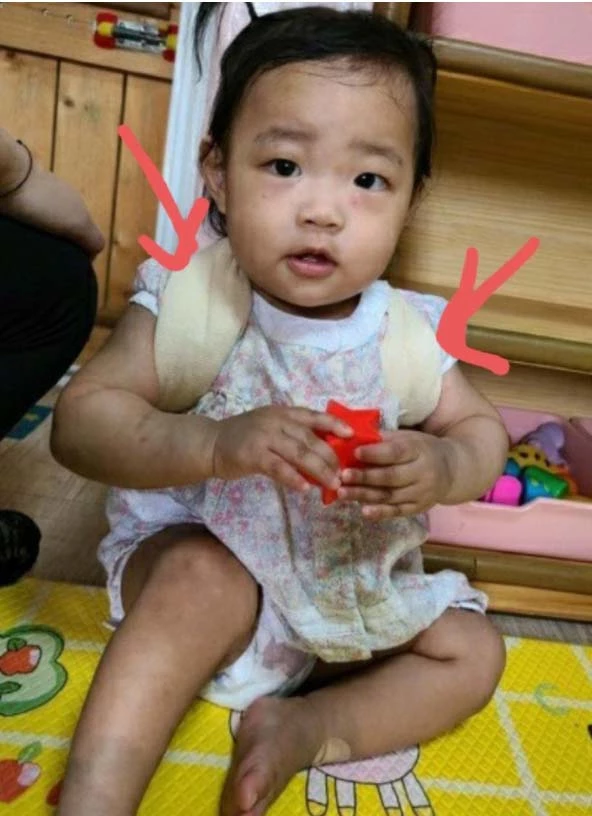 입양 후 정인이의 모습. 밝은 모습이 완전히 사라졌다. 몸 곳곳에 성한 곳이 없어 보인다.