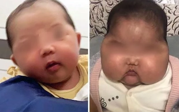 크림을 바르기 전 (왼쪽)과 후(오른쪽)  / 이하 웨이보