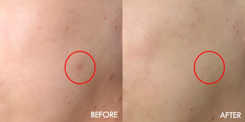 트러블이 사라지고 붉은기가 개선됨.