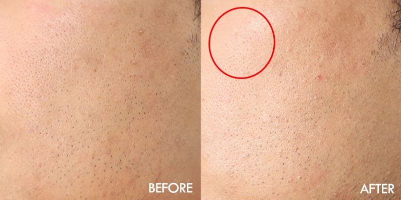 약간의 광이 남.