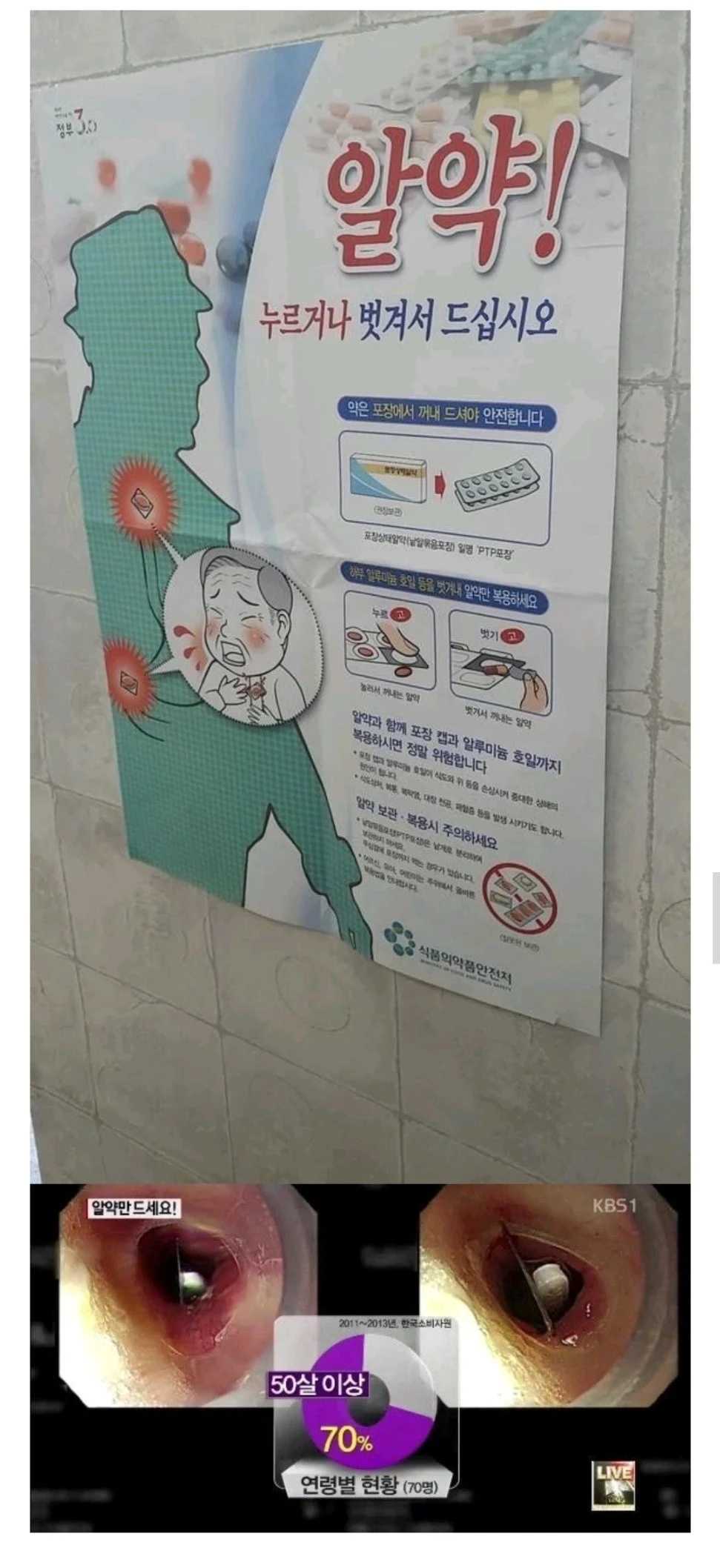 알약 복용 주의법을 홍보하는 식약처 포스터(상)와 한국소비자원에서 조사한 피해 통계. /웃긴대학