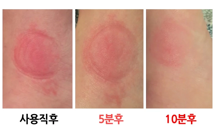 “이제 모기 물려도 걱정 없어요” 다가오는 여름철 캠핑 필수템