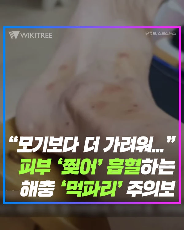 “모기보다 더 가려워...” 피부 ‘찢어' 흡혈하는 해충 ‘먹파리' 주의보