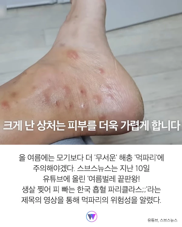 “모기보다 더 가려워...” 피부 ‘찢어' 흡혈하는 해충 ‘먹파리' 주의보