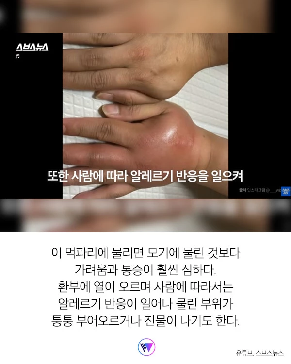 “모기보다 더 가려워...” 피부 ‘찢어' 흡혈하는 해충 ‘먹파리' 주의보