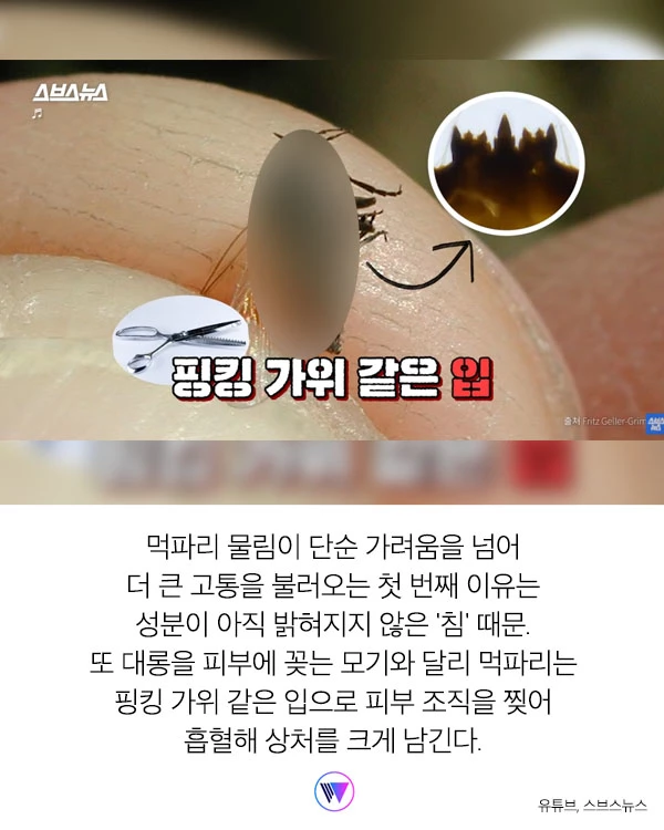 “모기보다 더 가려워...” 피부 ‘찢어' 흡혈하는 해충 ‘먹파리' 주의보