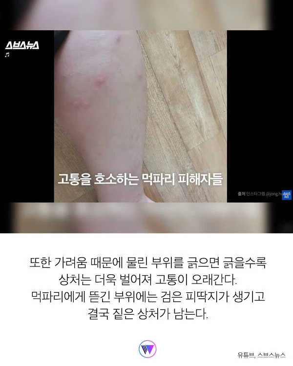 “모기보다 더 가려워...” 피부 ‘찢어' 흡혈하는 해충 ‘먹파리' 주의보