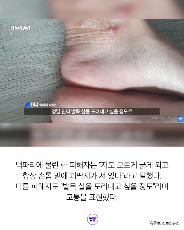 “모기보다 더 가려워...” 피부 ‘찢어' 흡혈하는 해충 ‘먹파리' 주의보