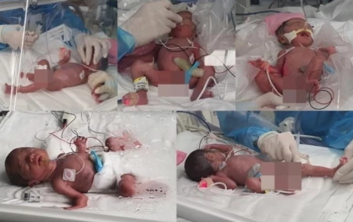 한국에서 34년 만에 태어난 다섯쌍둥이. / 서울대병원 제공.