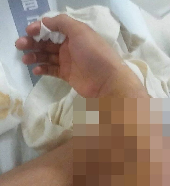 A 장병이 공개한 오른팔 사진 / 페이스북 '육군훈련소 대신 전해드립니다'