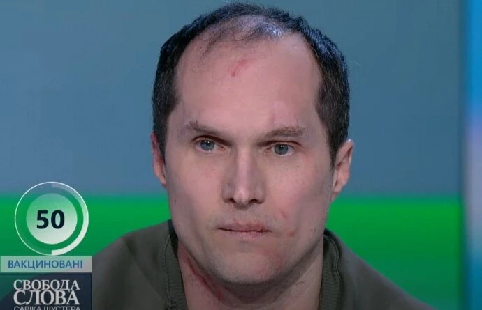 사건 직후 유리 부투소프 기자 모습 / 에펨코리아