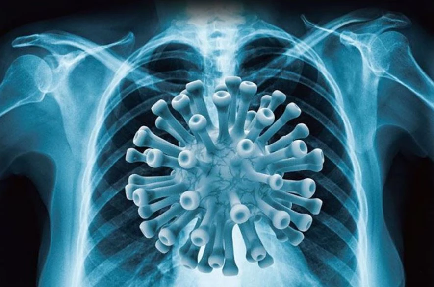 부산광역시 내에서 마지막 ‘코로나청정지역’ 기장군에서 신규 확진자 510명이 폭증하여 '역대 최다' 기록을 연이어 경신하고 있다. / 사진제공=셔트스톡