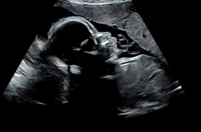 이하 진태현 인스타그램