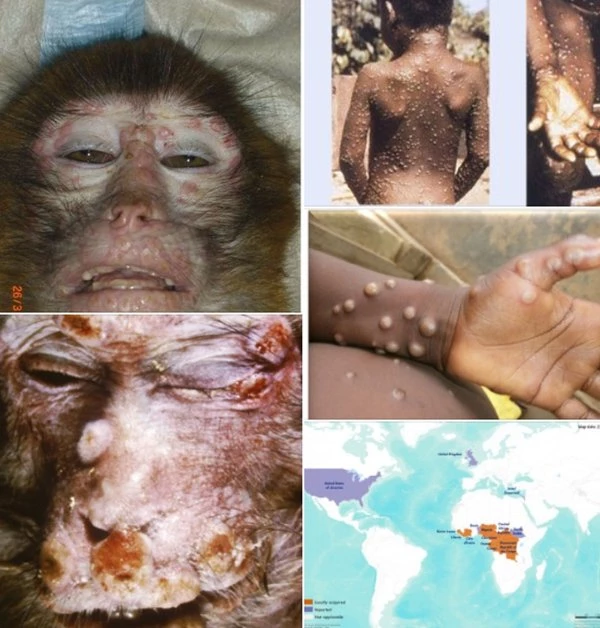 / 김인중 박사 페이스북