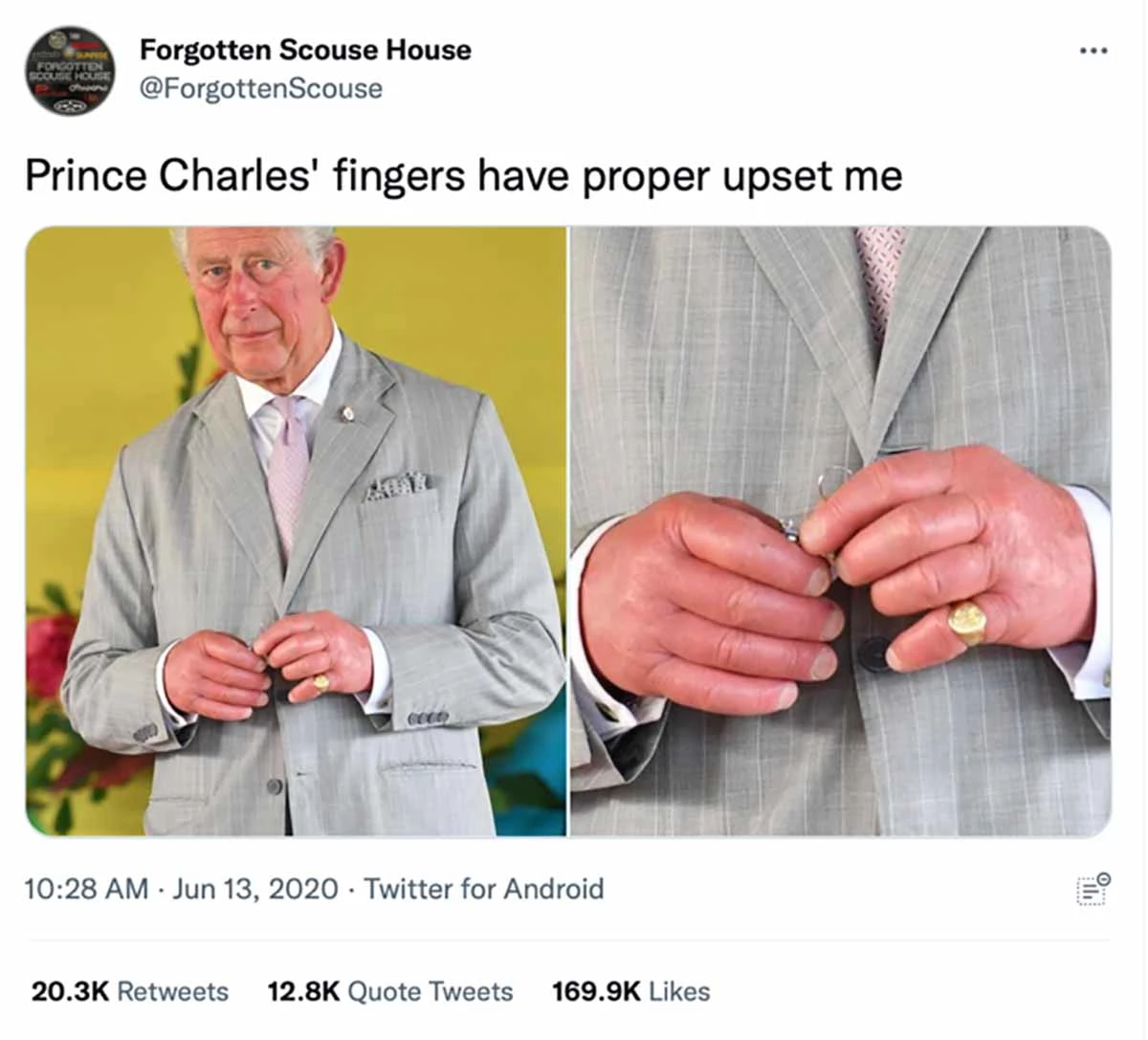 칠스 3세의 부은 손을 담은 사진이 트위터 등을 통해 퍼지고 있다.