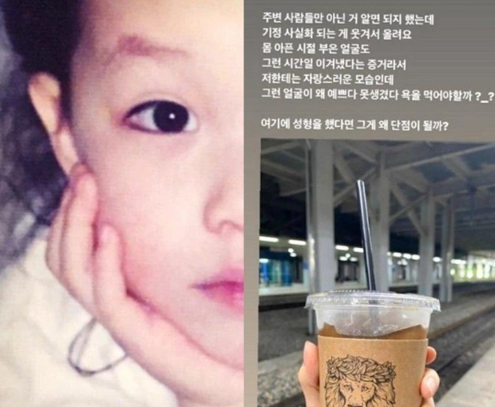 포모스 글 '성형 루머 때문에 인증샷 올린 아나운서' 캡처. / 이하 포모스, 현재는 비활성화된 이정현 아나운서 인스타그램 계정