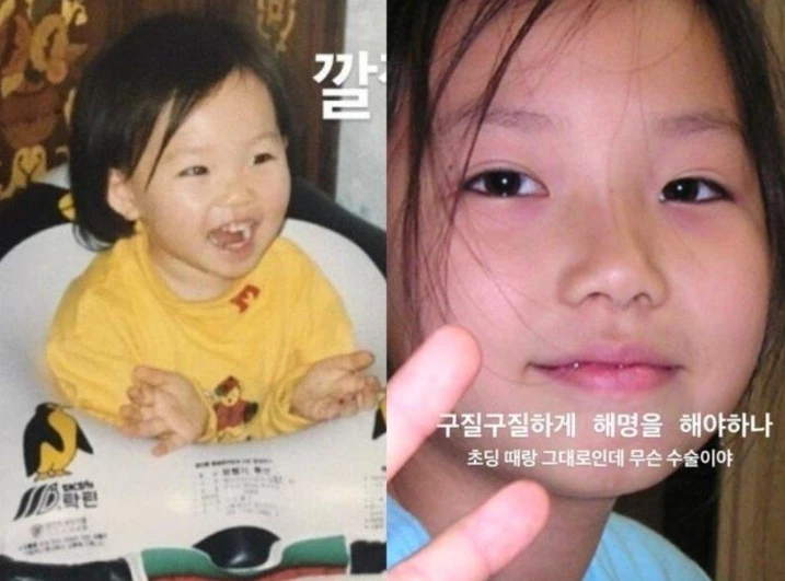 '성형수술한 거 아냐?' 말에 어린 시절 사진 공개해버린 아나운서 (사진) 