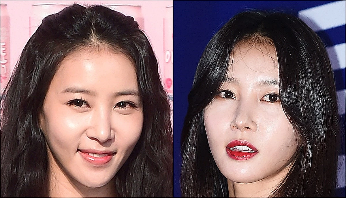 뉴스1