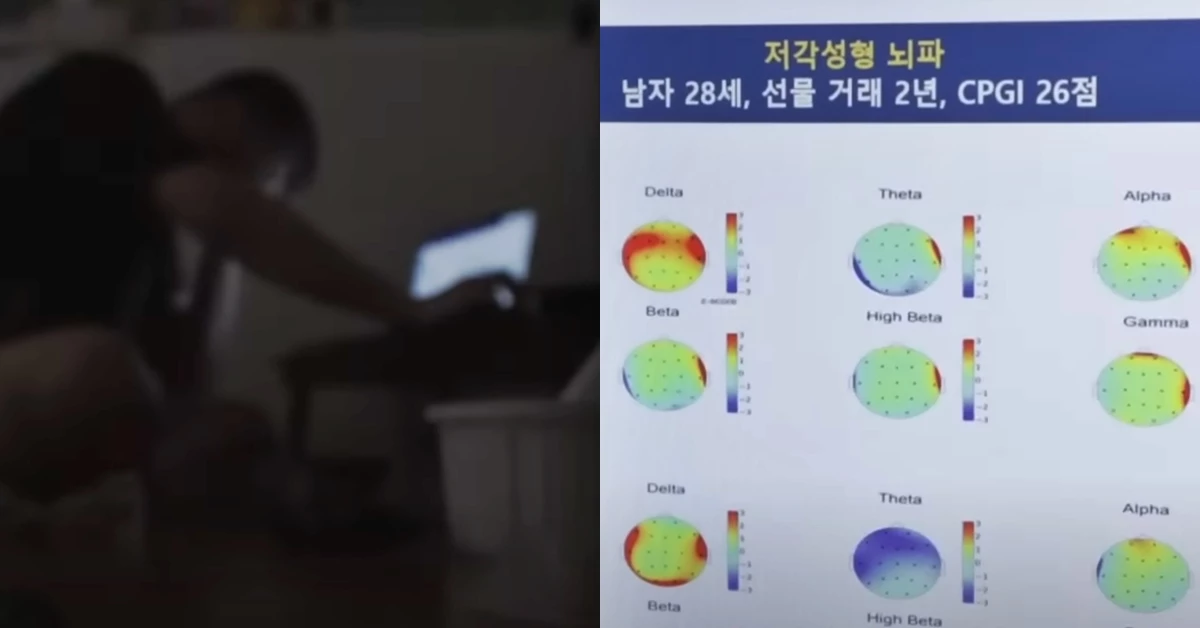 노트북 화면으로 코인 시세를 확인하고 있는 남성(좌)과 코인 선물 거래 2년 차 박진수(가명) 씨의 뇌파 상태. /이하 KBS1