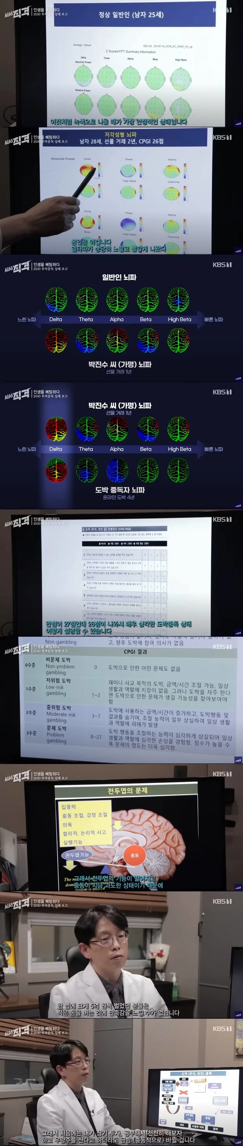 박진수(가명) 씨의 뇌파 진단 및 도박중독 자가진단 결과를 설명하고 있는 정신건강의학과 전문의.