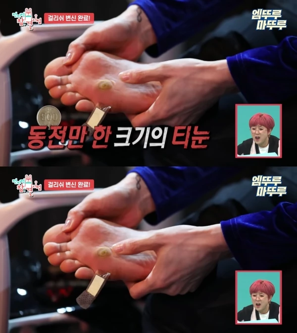 2021년 MBC '전지적 참견 시점'에 출연한 조권 / 유튜브, 엠뚜루마뚜루 : MBC 공식 종합 채널