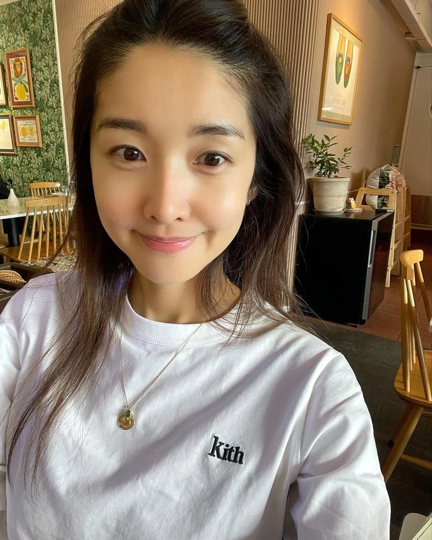 배우 김빈우가 3월 15일 인스타그램을 통해 눈매 교정 수술을 받았다고 밝혔다. / 이하 김빈우 인스타그램