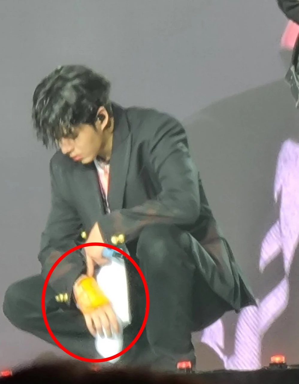 화상을 입은 윤재혁의 손에 대형 밴드가 부착돼 있다. / 트위터