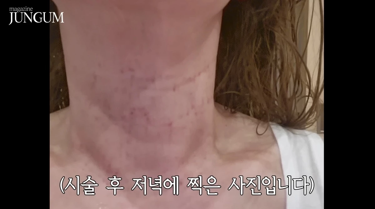 박준금이 시술받고 난 후 찍은 사진이다.