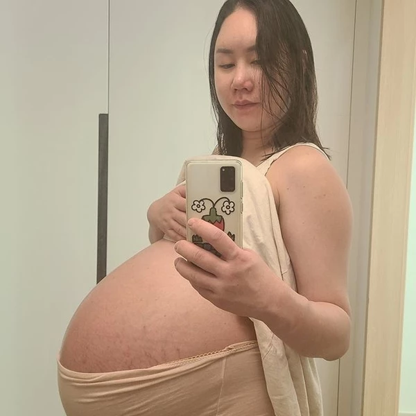 세쌍둥이 임신 당시 황신영