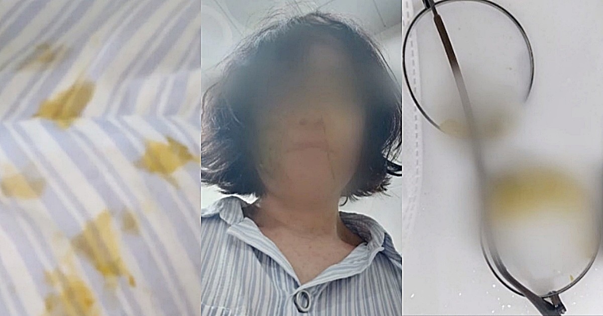 학부모에게 똥기저귀를 맞은 어린이집 교사 B씨 / MBC 뉴스