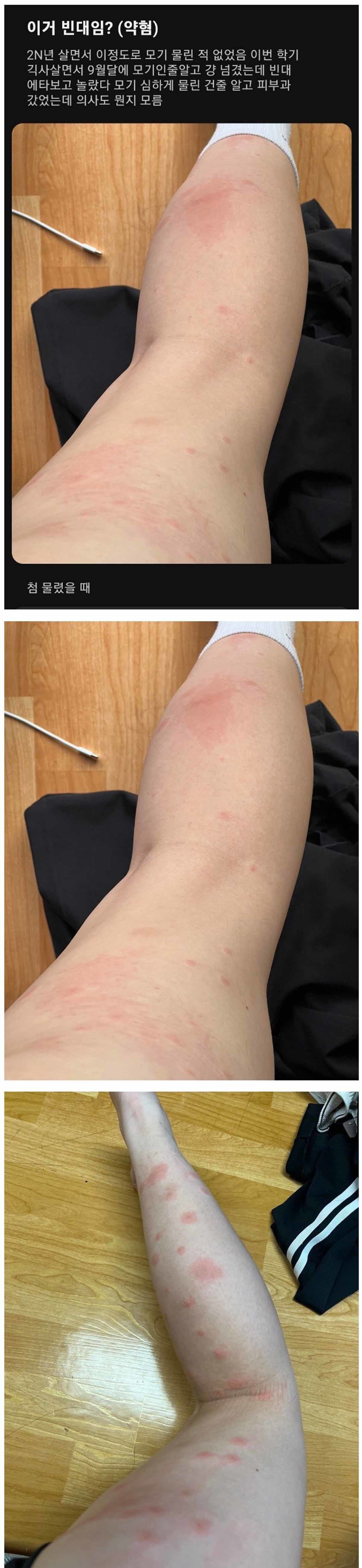 기숙사에서 생활하는 계명대 학생이 에브리타임에 올린 게시물.