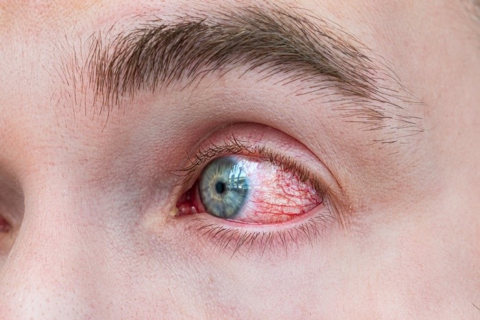 기사의 이해를 돕기 위한 사진 / Melnikov Dmitriy-Shutterstock.com