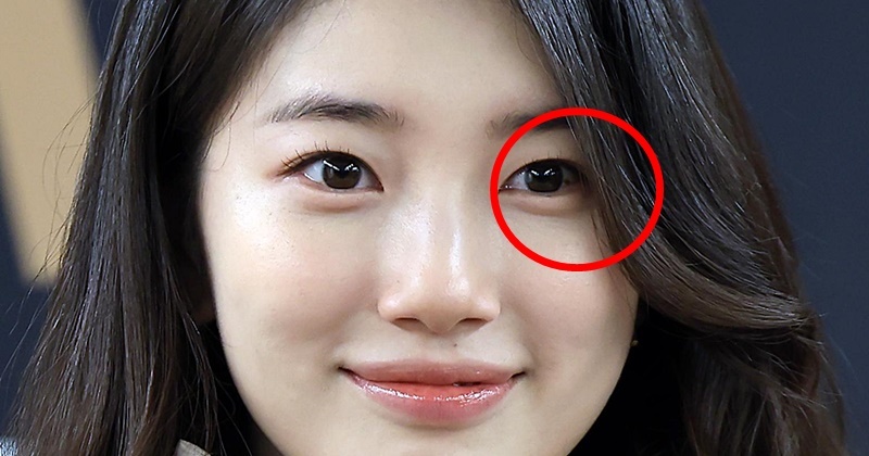 “그냥 두면 악성 종양…” <b>수지</b>, 수술 받았다