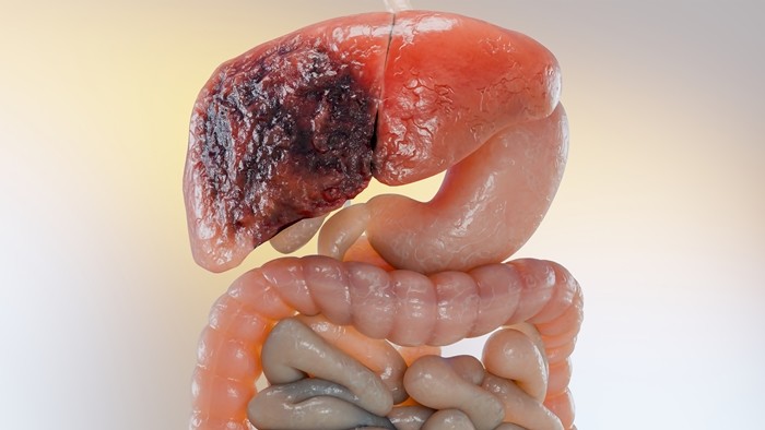 기사의 이해를 돕기 위한 사진 / ALIOUI MA-shutterstock.com