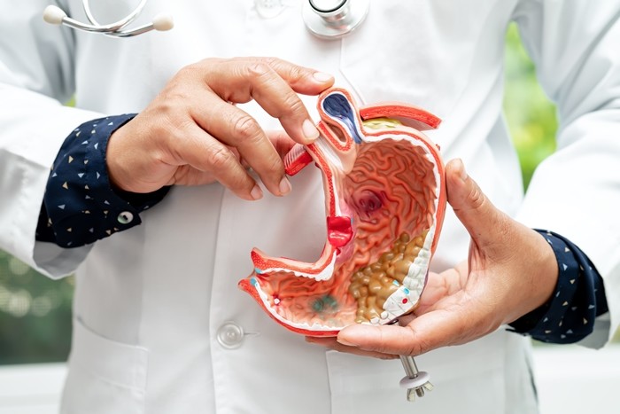기사의 이해를 돕기 위한 사진 / sasirin pamai-shutterstock.com