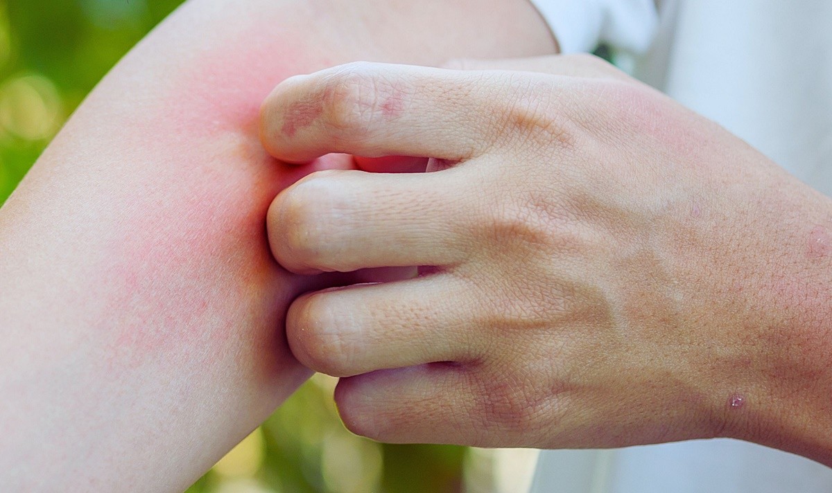 기사 이해를 돕기 위한 자료 사진 / pasindu feed-shutterstock.com