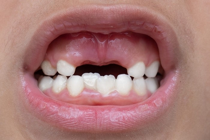 기사의 이해를 돕기 위한 사진 / sruilk-shutterstock.com