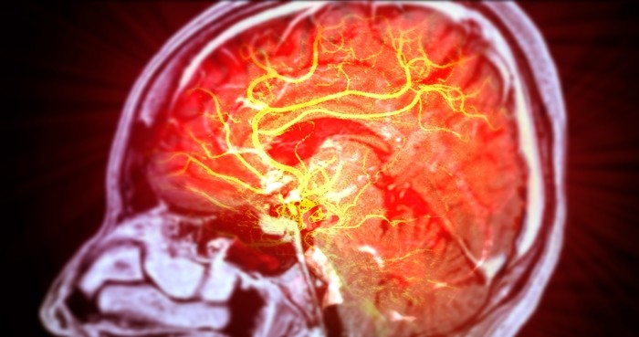 기사의 이해를 돕기 위한 사진 / Radiological imaging-shutterstock.com
