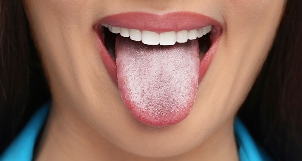 셔터스톡