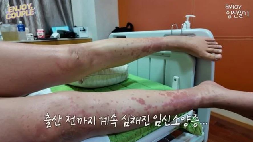 임라라 인스타그램