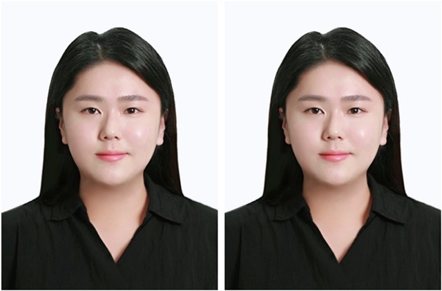 전남대병원 최윤희 복지사