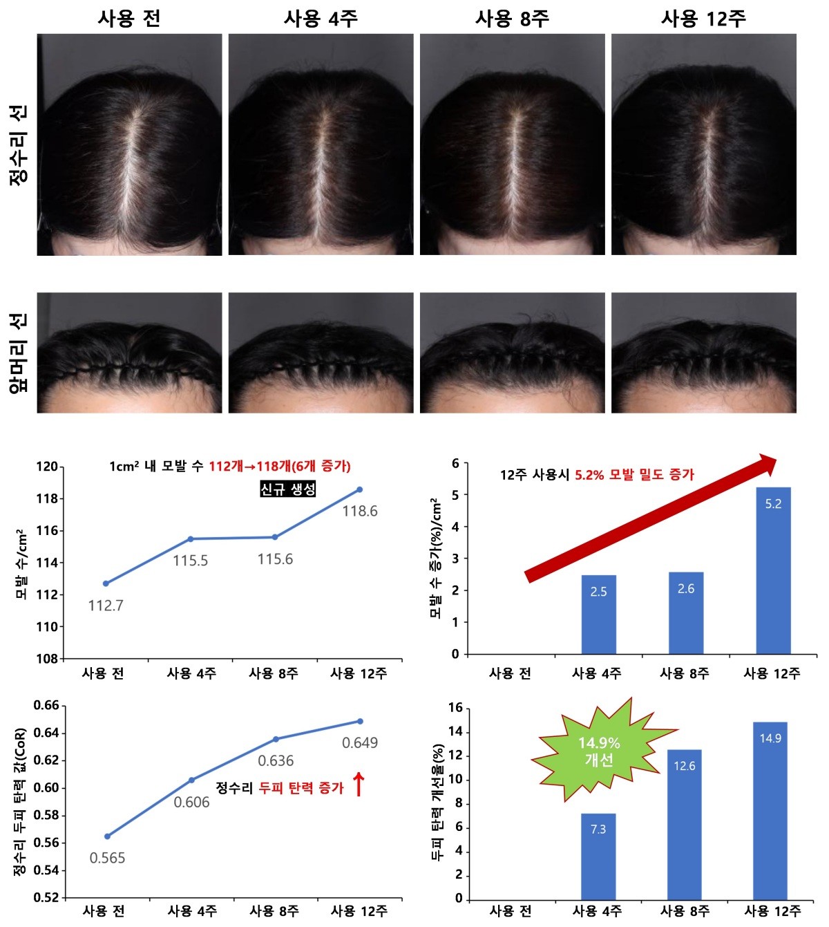 모발 밀도 및 두피 탄력이 개선된 모습의 자료. / 국립산림과학원 제공