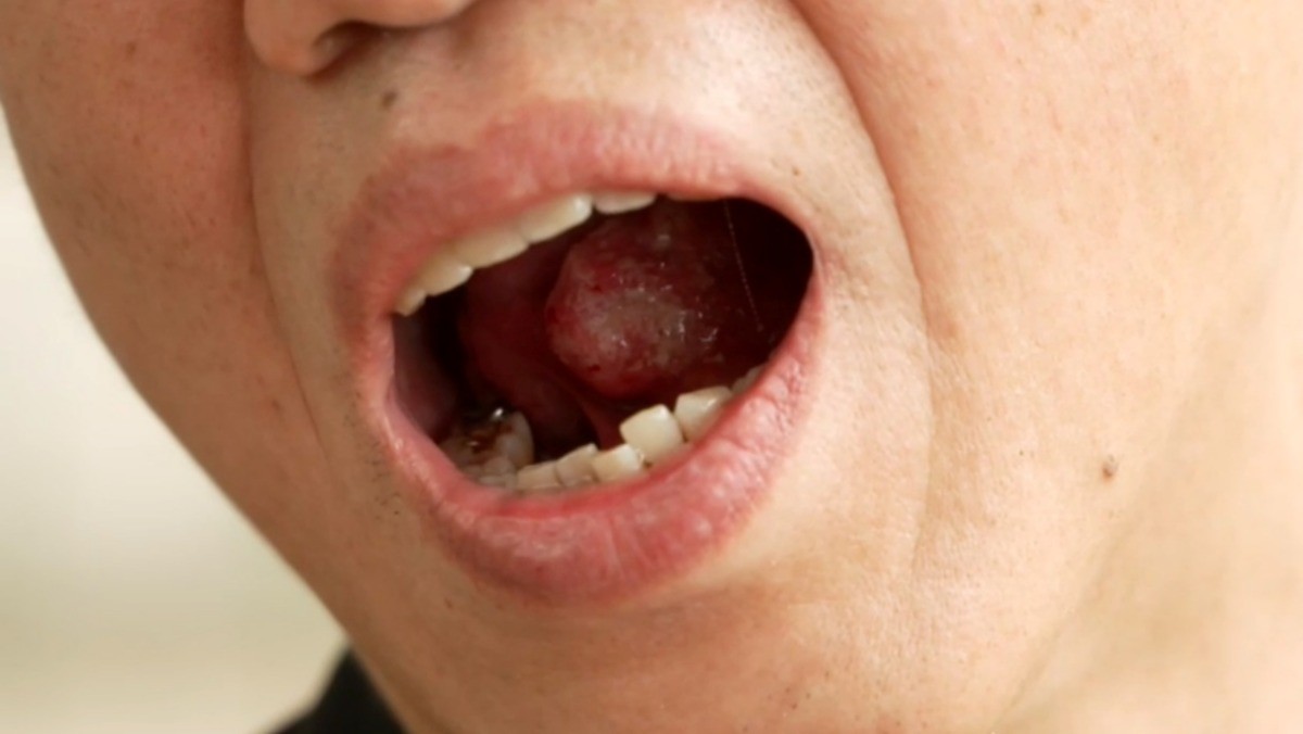 EBS '명의' 942회 방송 스틸컷. / EBS 제공