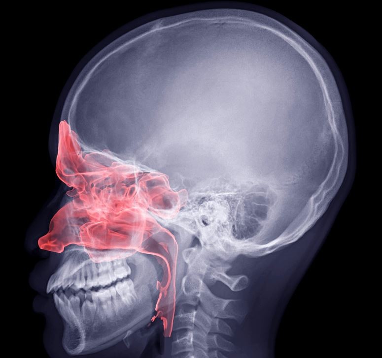 기사의 이해를 돕기 위한 사진 / Radiological imaging-shutterstock.com