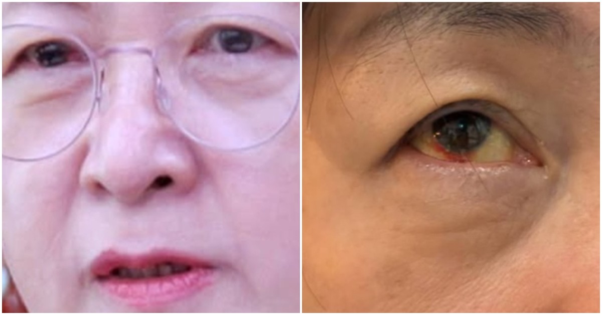 추미애 의원 얼굴. / 추미애 의원 페이스북