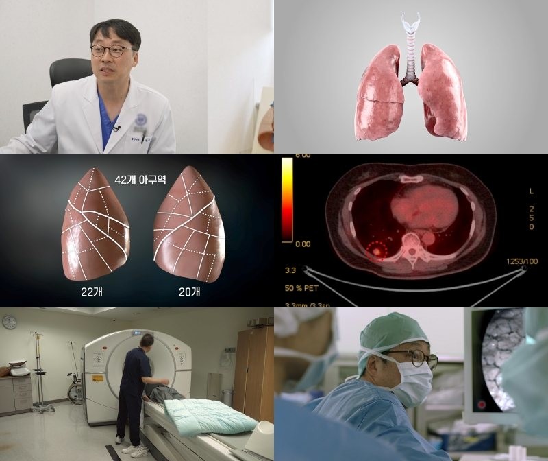 EBS '명의' 943회 방송 스틸컷. / EBS 제공