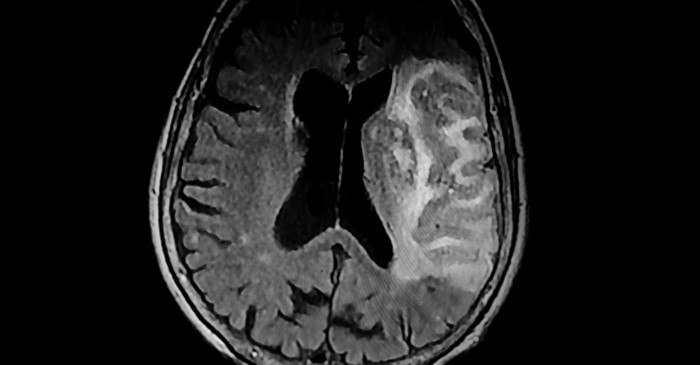 기사의 이해를 돕기 위한 사진 / Douglas Olivares-shutterstock.com