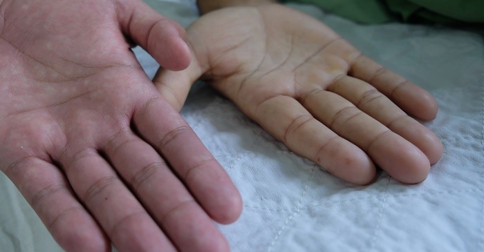 기사의 이해를 돕기 위한 사진 / Casa nayafana-shutterstock.com