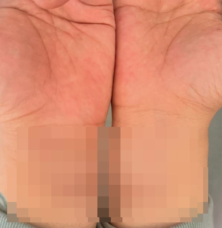 MC몽이 추가 글과 함께 올린 손목 사진 / MC몽 인스타그램